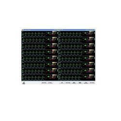 CENTRAL DE MONITORIZACION VSIGNVIEW