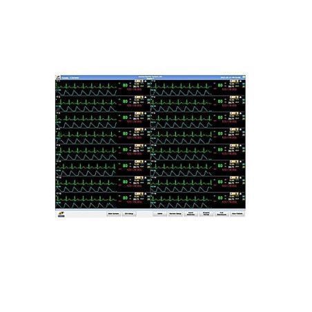 CENTRAL DE MONITORIZACION VSIGNVIEW